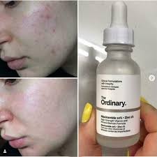 Skin Care & Beauty